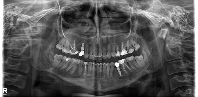 Radiografia Panormica